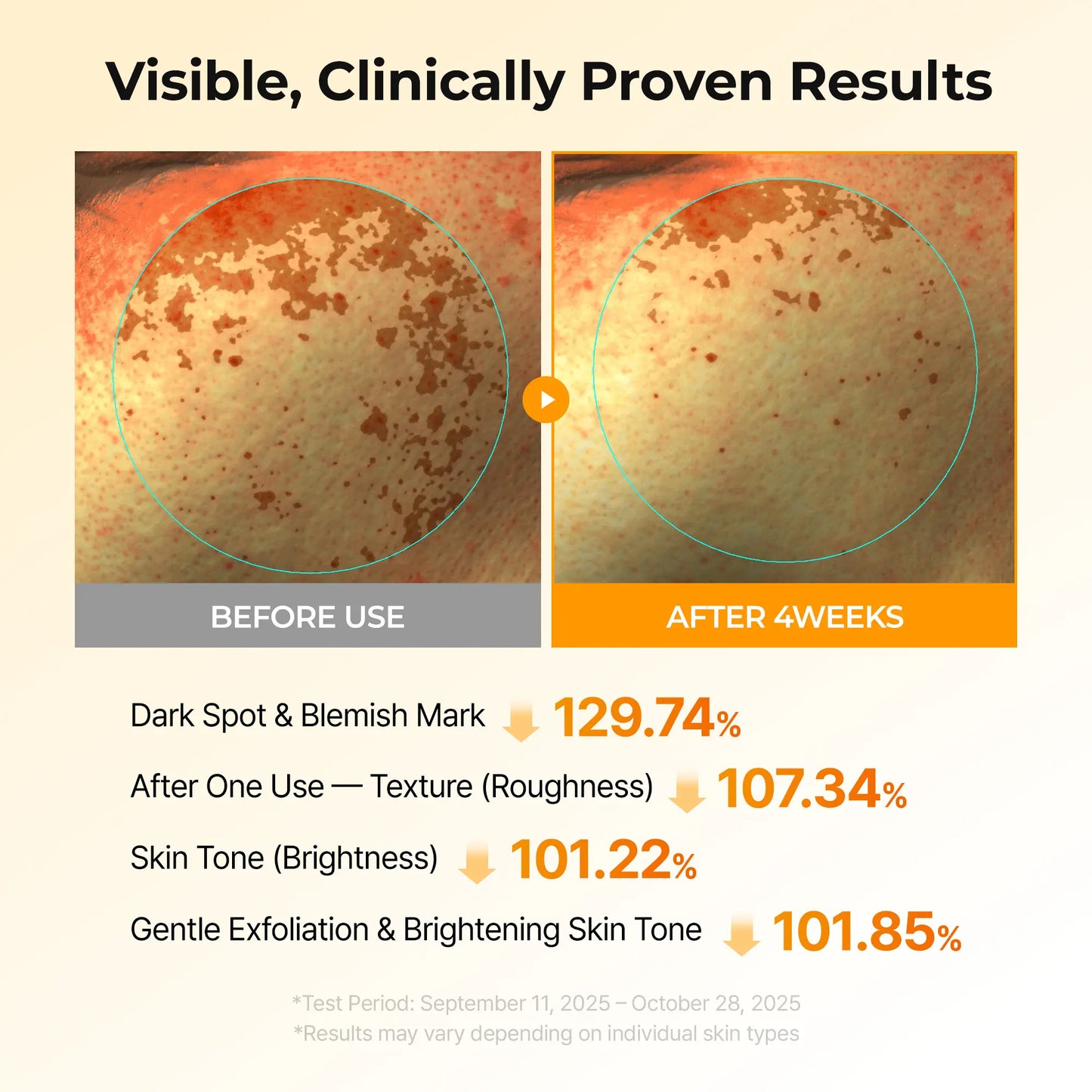 Kojic Acid & Turmeric TX Toner Pads